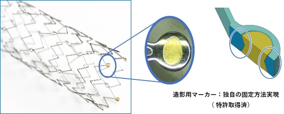 X-ray marker for medical stent